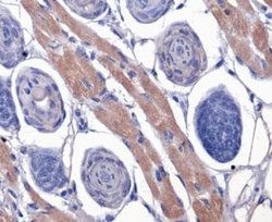 PAR1/Thrombin Receptor Antibody (N2-11) - Azide and BSA Free, Novus Biologicals